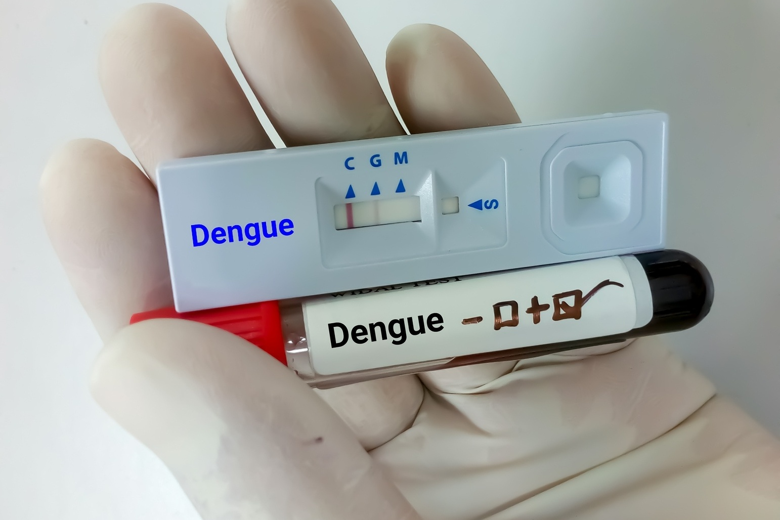 "Falso negativo" na dengue: Por que pacientes com sintomas clássicos podem testar negativo - Foto: iStock